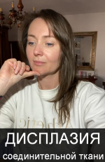 oksana-terexova-displazija-soedinitelnoj-tkani-2023.png