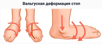 Безымянный.jpg