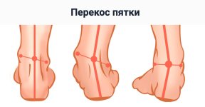 Безымянный.jpg