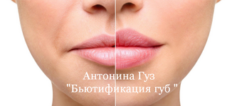Скачать [Антонина Гуз] Бьютификация губ (2023).png